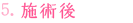 施術後